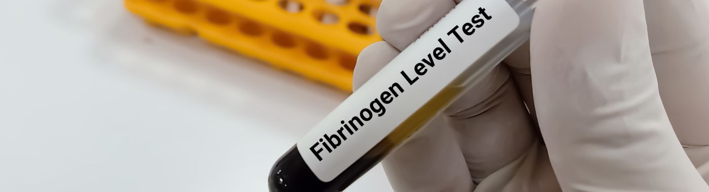 fibrinogen-test.jpg