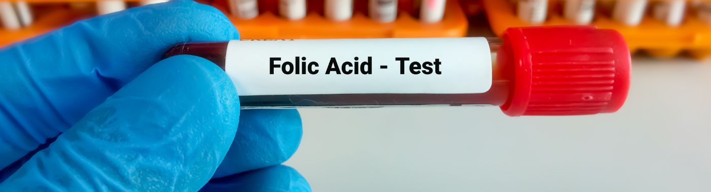 folic-acid-test.jpg