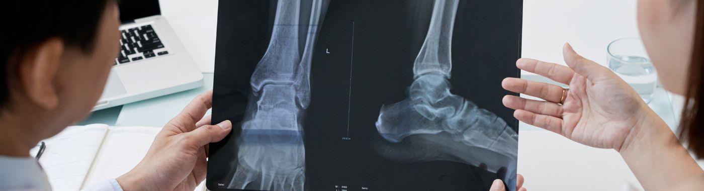 foot-x-ray.jpg