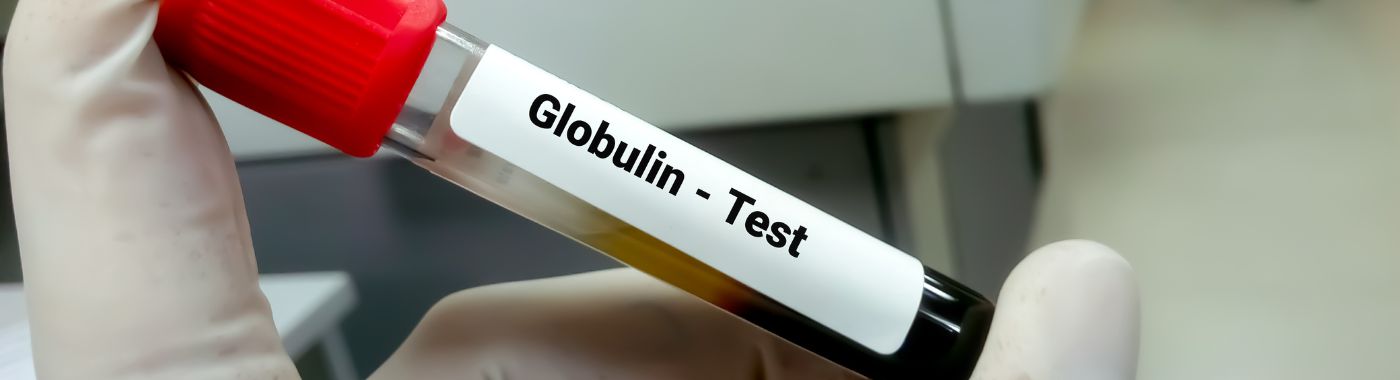 Globulin Test