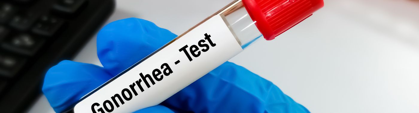 Gonorrhea Test