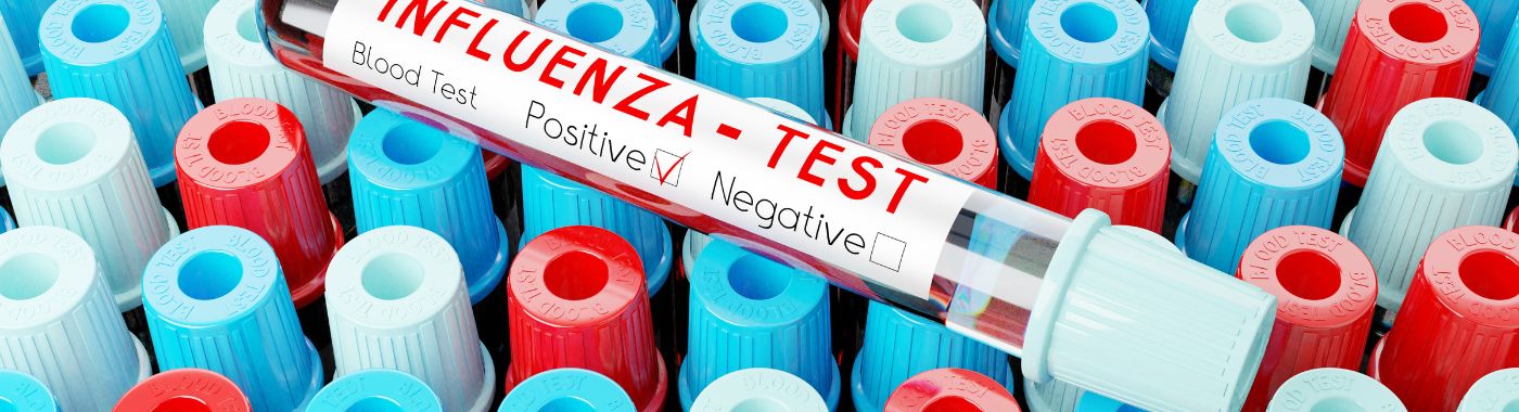 influenza test