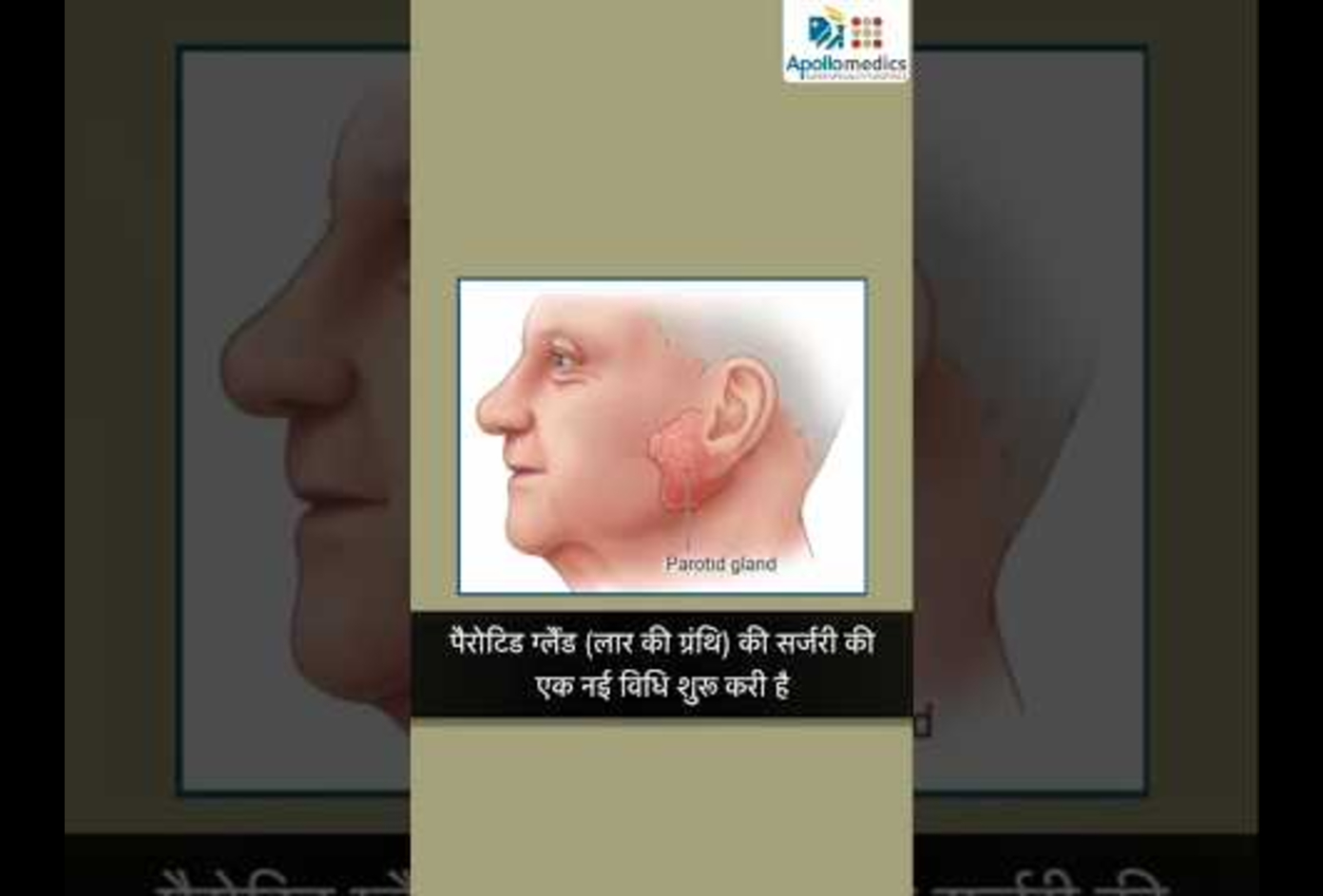 Incisional head and neck cancer surgery