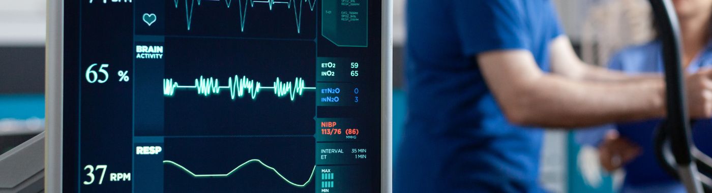 Nuclear Cardiac Stress Test