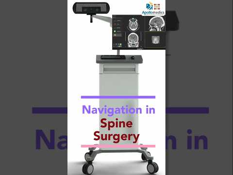  Navigation in Spine Surgery