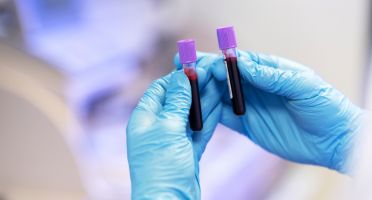 RDW Blood Test