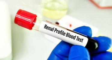 Renal Profile Test