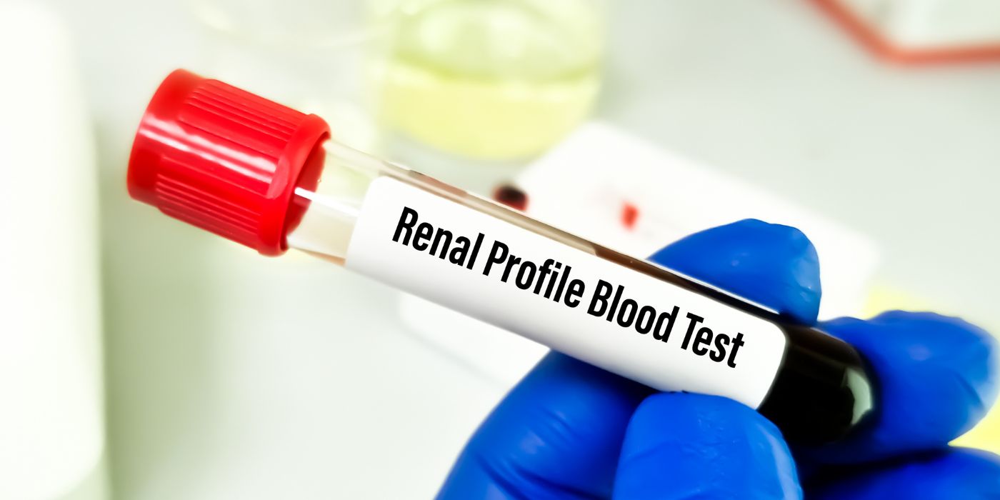 Renal Profile Test