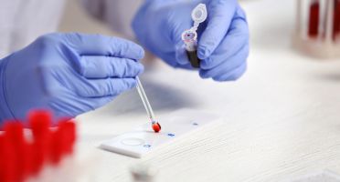 Reticulocyte Count Test