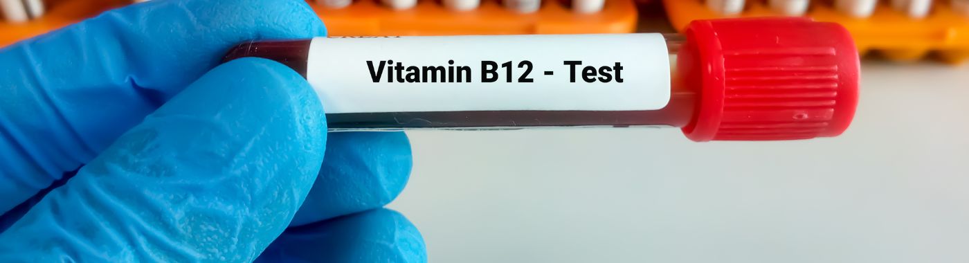 Serum Vit B12