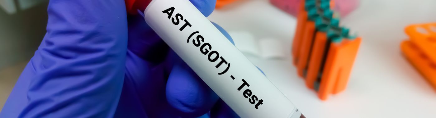 SGOT Test
