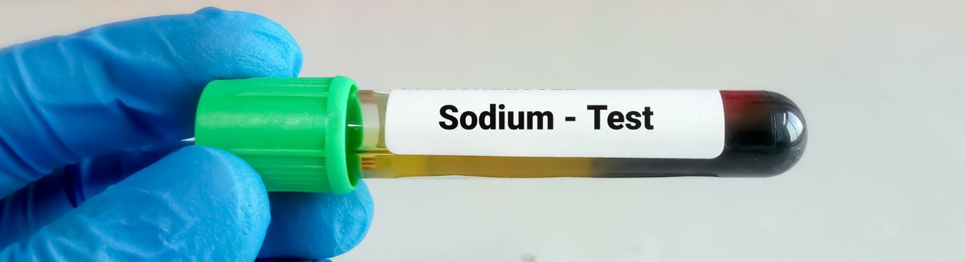 Sodium Test