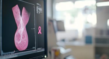 Stereotactic Breast Biopsy