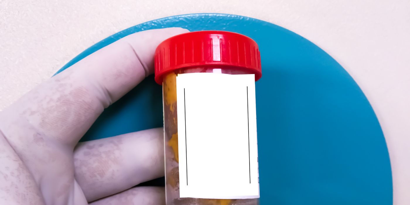 Stool Routine Test - Purpose, Results, Normal Range, and more