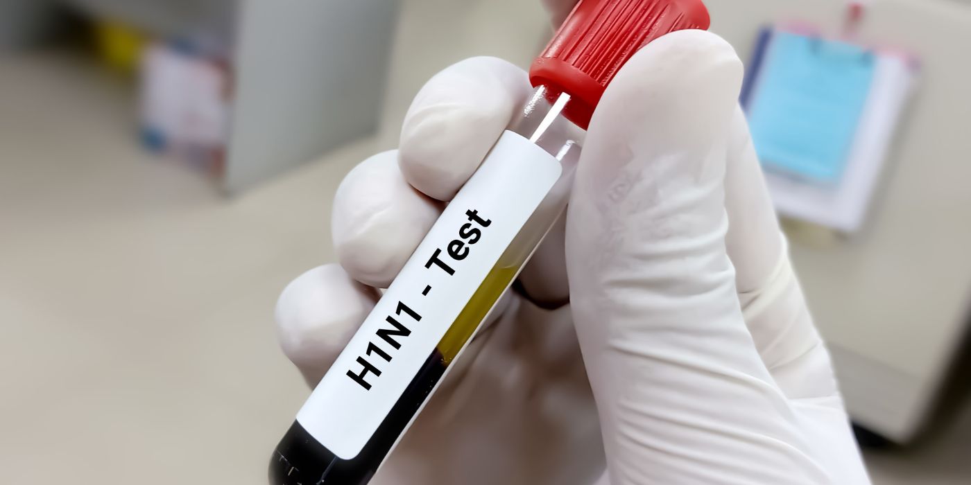 Swine Flu Test
