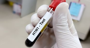 Swine Flu Test
