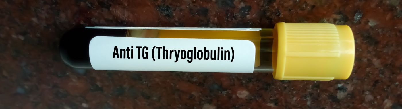 Thyroglobulin test