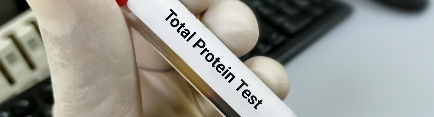 Total Protein Test