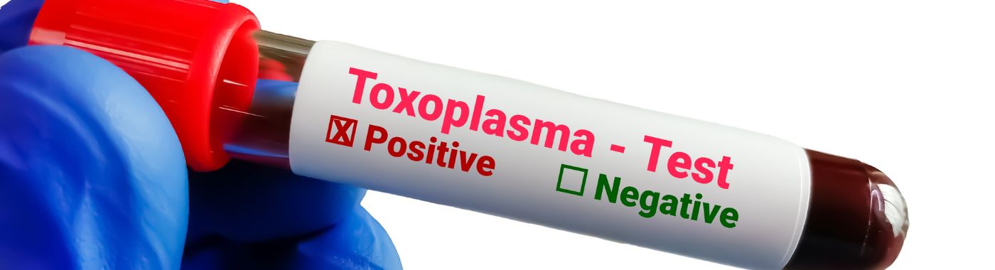 Toxoplasma Test