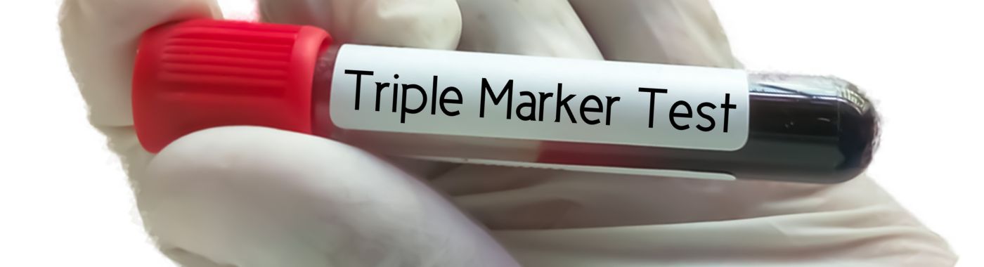 Triple Marker Test