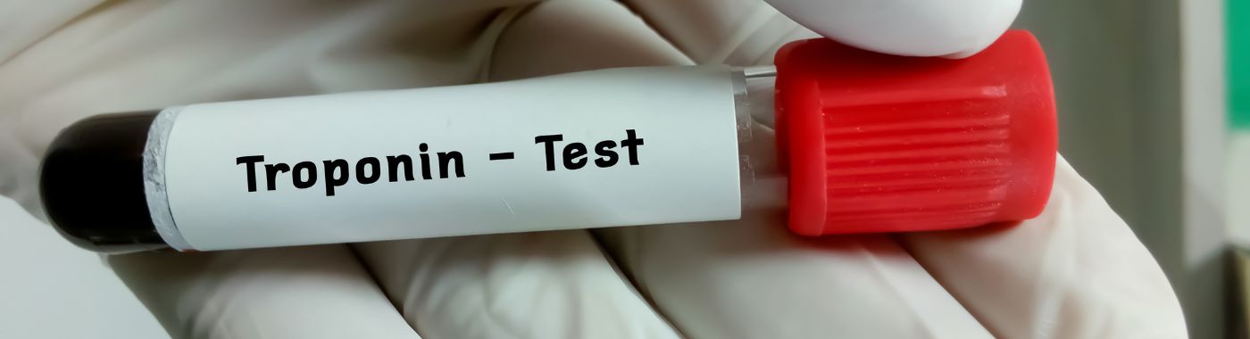Troponin Test