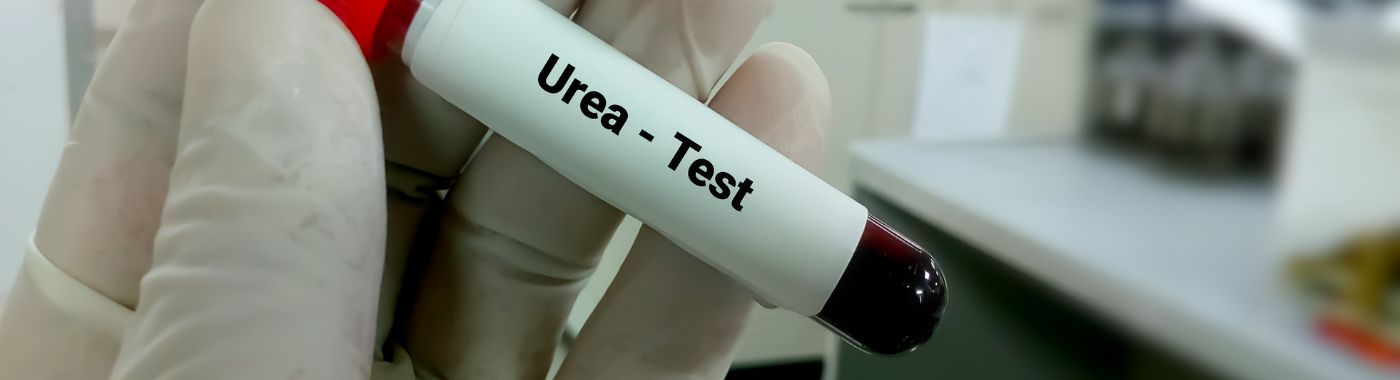 Urea Test