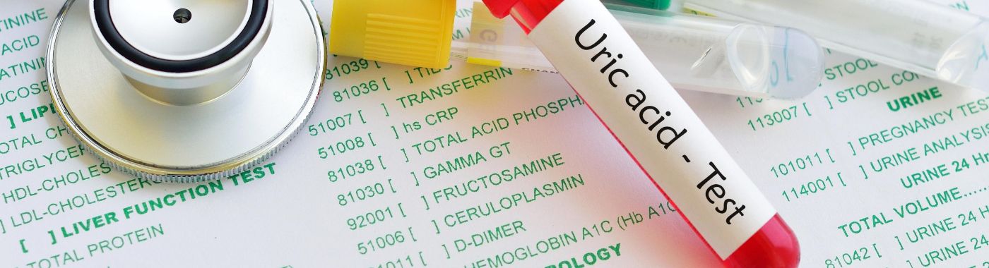 Uric Acid Test