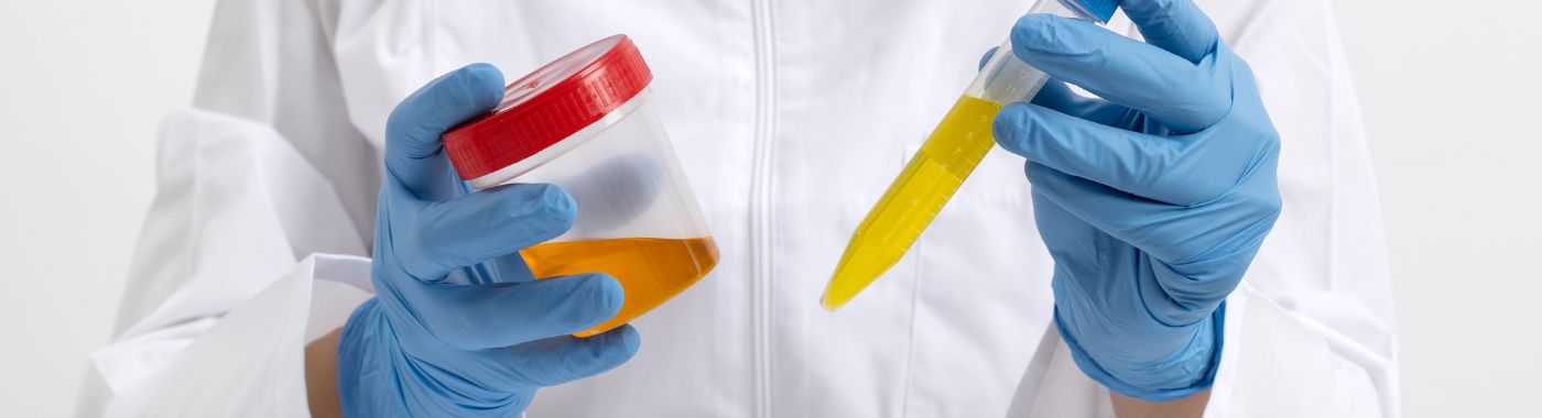 Urine Albumin-Creatinine Ratio