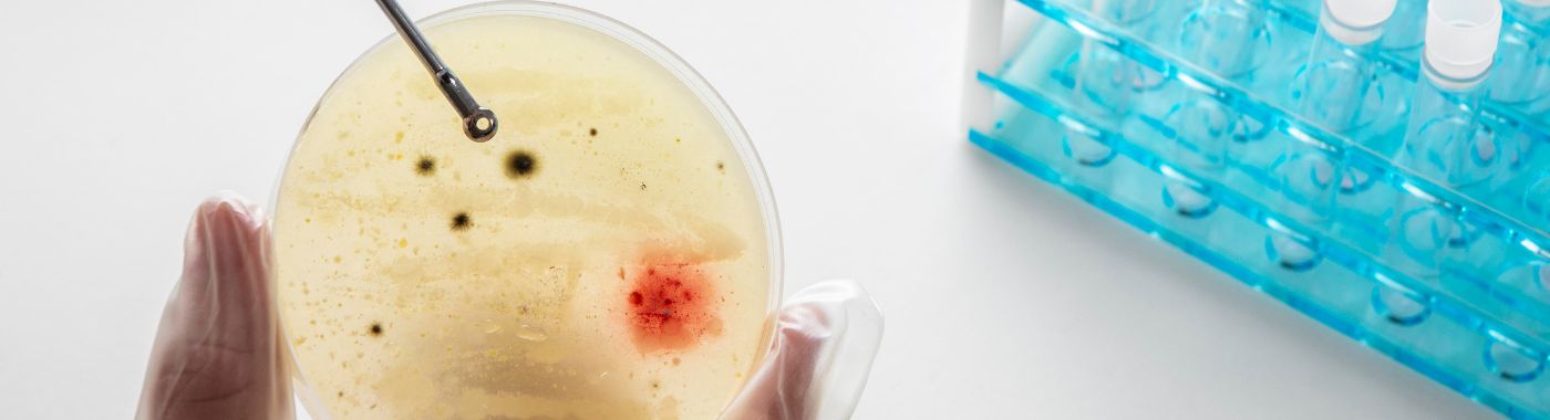 Urine Cytology