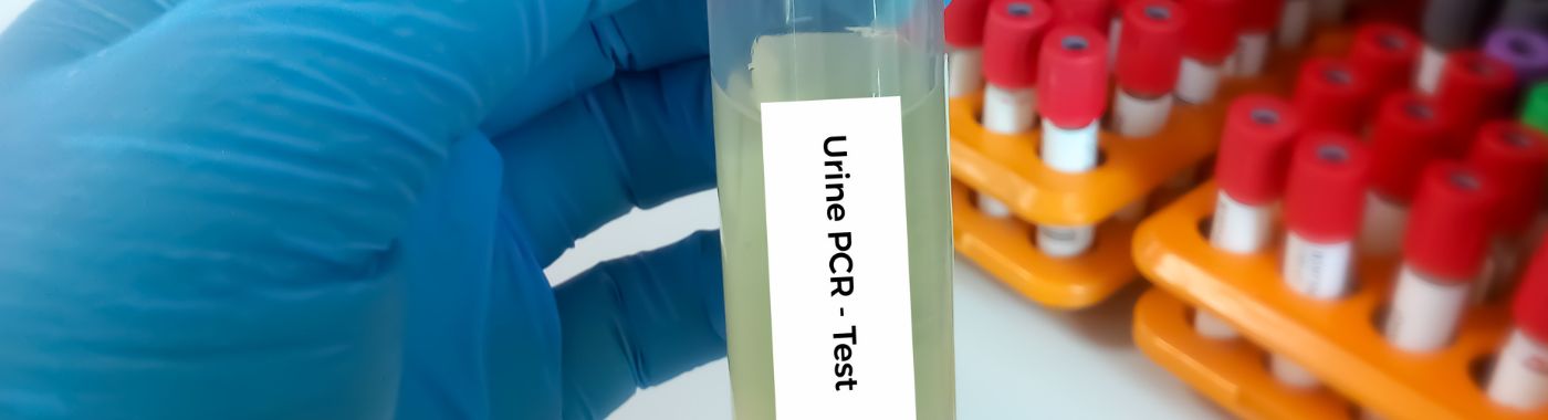 Urine Protein Creatinine Ratio