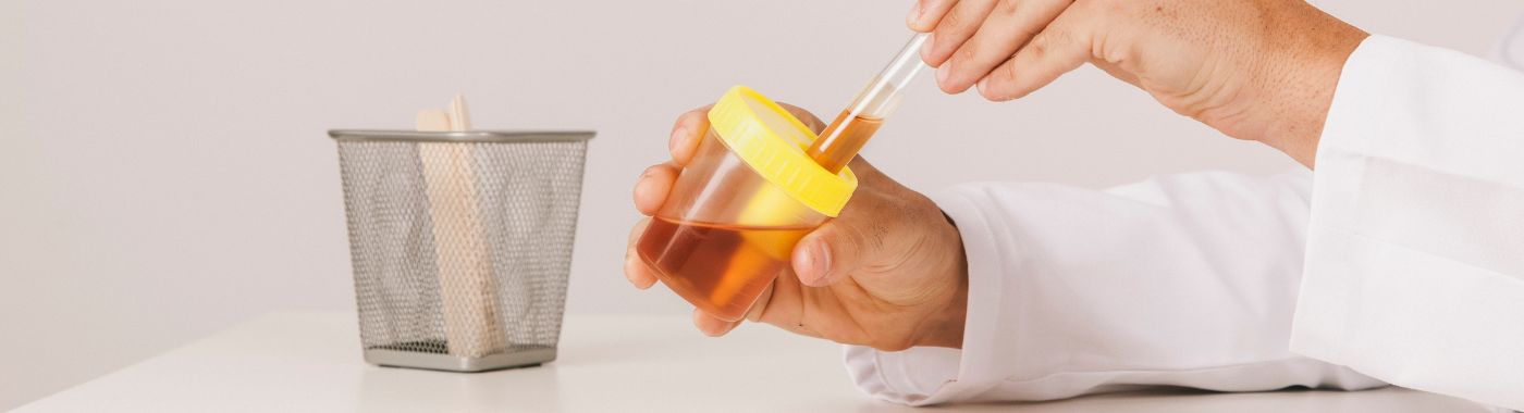 Urine Routine Test