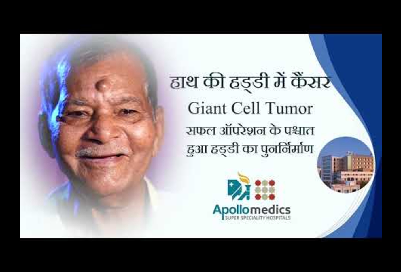 Giant Cell Tumor