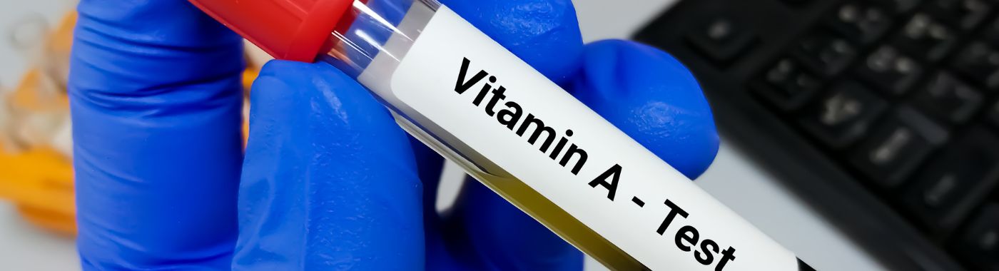 Vitamin A Test