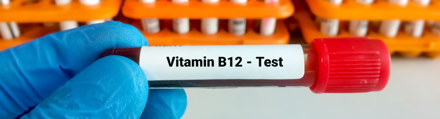 Vitamin B12 Test