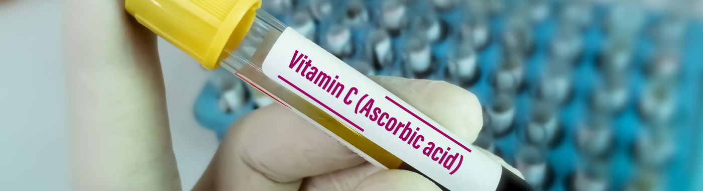 Vitamin C Test