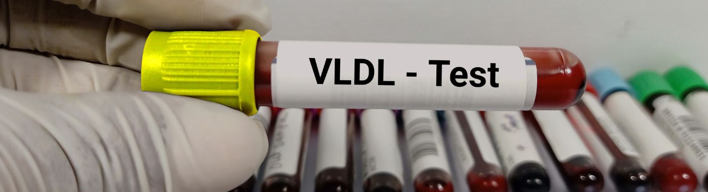 VLDL Test