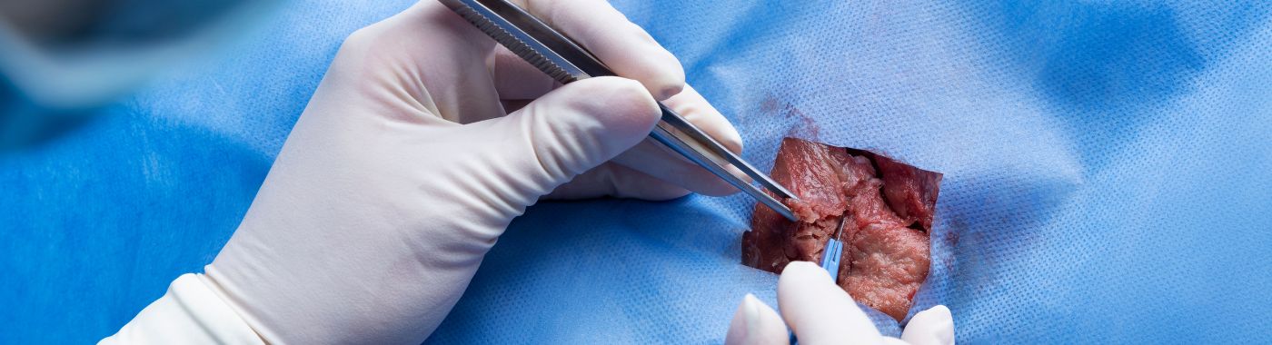 What is Anorectal Malformation Repair