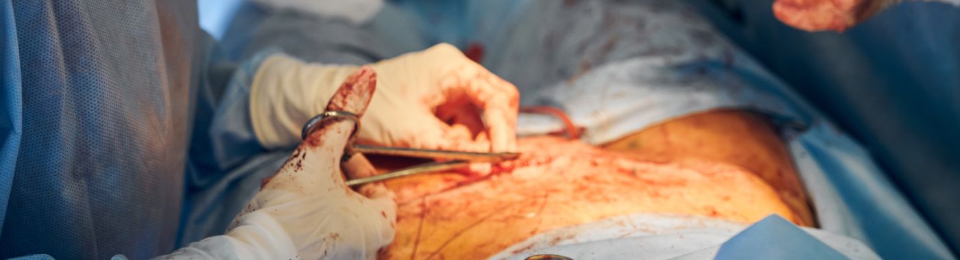What is Aortic Root Surgery