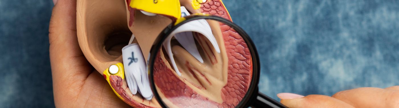 Ano ang Pag-aayos ng Aortocaval Fistula