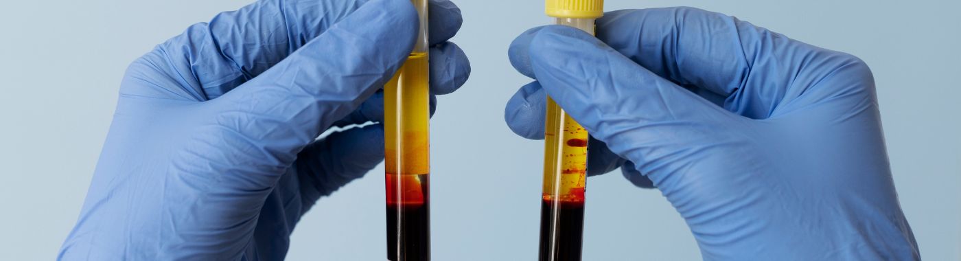 What Is the Connection Between Iron and Blood Hemoglobin