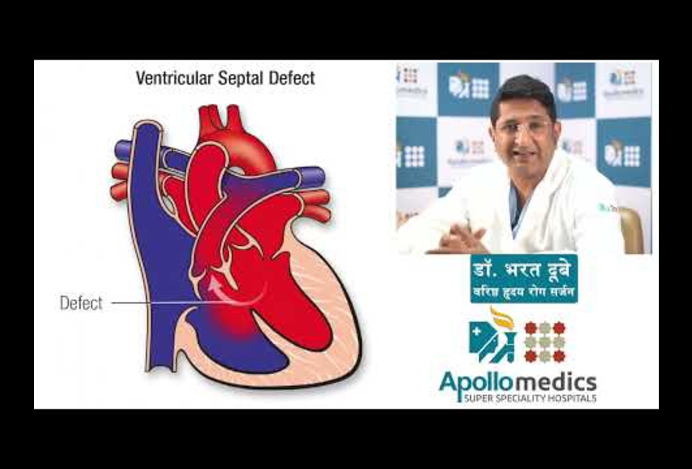 ASD/VSD (hole in the heart) in children,