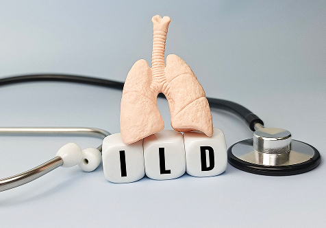 Interstitial Lung Diseases Clinic 
