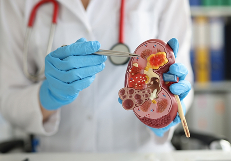 Kidney Stone Clinic