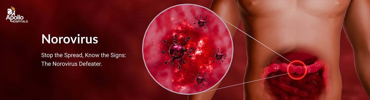 Norovirus: Symptoms, Spread, Treatment and Prevention Guide