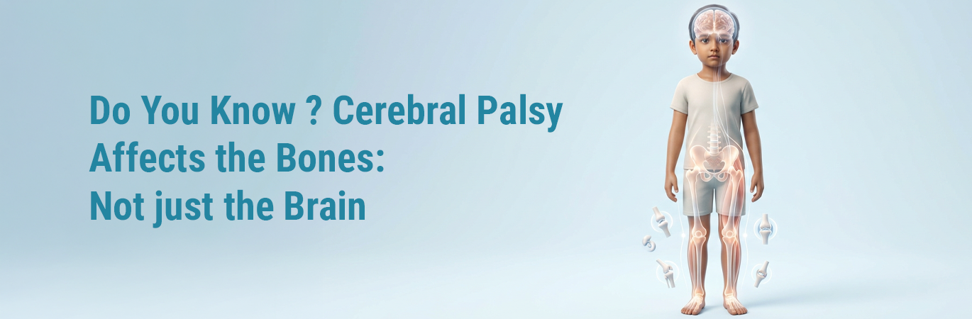 Do You Know ? Cerebral Palsy Affects the Bones: Not just the Brain
