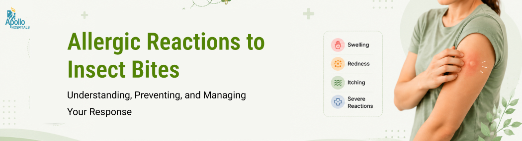 Allergic Reactions to Insect Bites: Symptoms, Treatment & Prevention