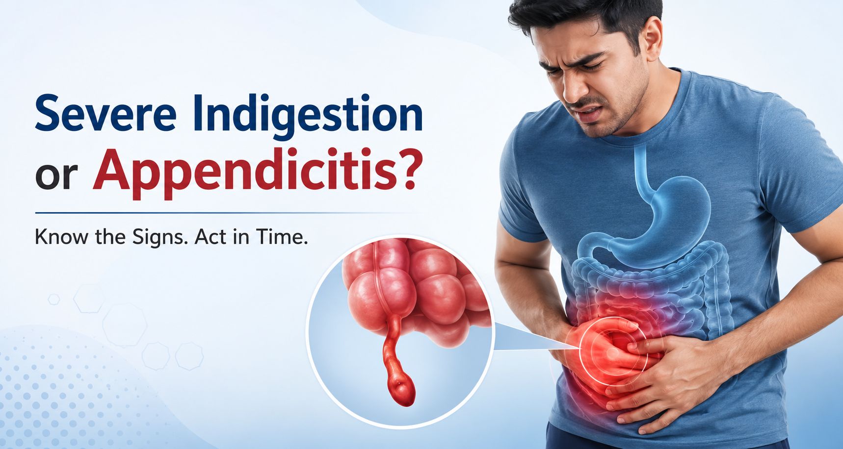 How to Spot the Difference Between Severe Indigestion and Appendicitis