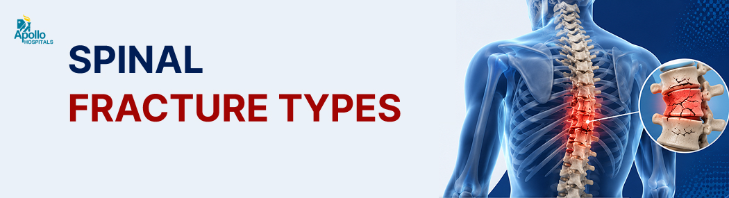 Spinal Fracture Types: Symptoms, Causes and Treatment