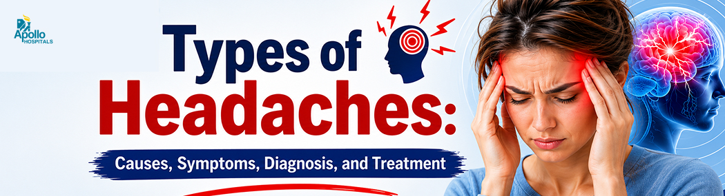 Types of Headaches: Causes, Symptoms and Treatment