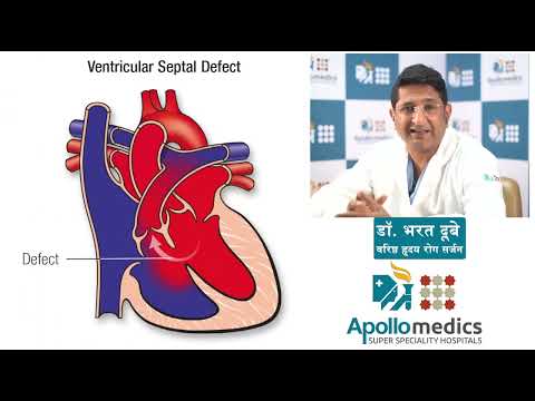 lucknow cardiology awareness thumbnail - 7